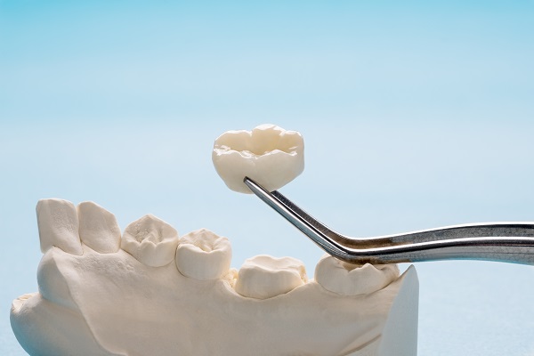 How A Tooth Is Prepared To Have A Dental Crown Restoration